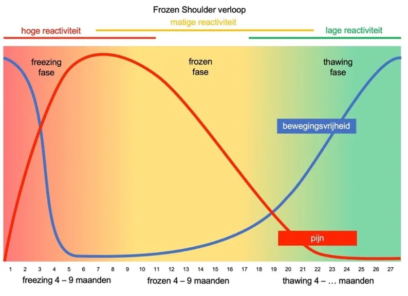 Grafiek van het verloop van een frozen shoulder over ongeveer 27 maanden: de pijn is hoog in de freezing-fase en daalt daarna; de bewegingsvrijheid daalt eerst sterk en herstelt in de thawing-fase.